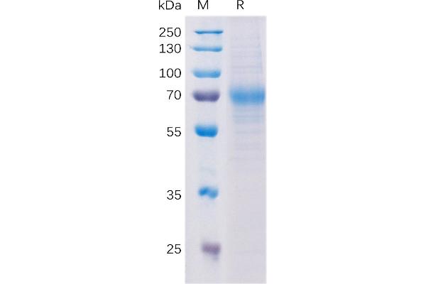 LY9 Protein (AA 48-454) (His tag)