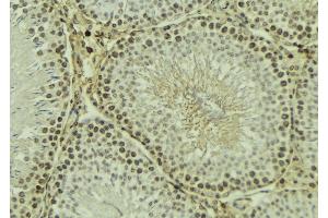 ABIN6269091 at 1/100 staining Mouse testis tissue by IHC-P. (Integrin beta 3 antibody  (C-Term))