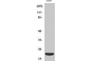 Western Blot analysis of various cells using TNF-β Polyclonal Antibody diluted at 1:1000. (LTA Antikörper  (Internal Region))