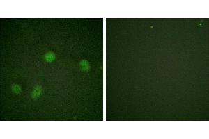 P-peptide - +Immunofluorescence analysis of HeLa cells, using Raf1 (Phospho-Ser621) antibody. (RAF1 antibody  (pSer621))