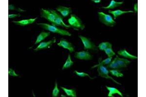 Immunofluorescence staining of Hela Cells with  at 1:50, counter-stained with DAPI. (Recombinant GSK3 beta antibody)