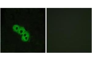 Immunofluorescence analysis of MCF7 cells, using GPR109 Antibody. (GPR109 antibody  (AA 285-334))