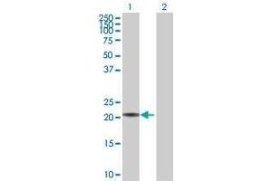 Lane 1: MED18 transfected lysate ( 23. (MED18 293T Cell Transient Overexpression Lysate(Denatured))