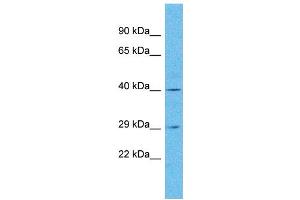 Western Blotting (WB) image for anti-Olfactory Receptor, Family 4, Subfamily N, Member 5 (OR4N5) (C-Term) antibody (ABIN2447828) (OR4N5 antibody  (C-Term))