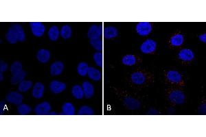 Immunocytochemistry/Immunofluorescence analysis using Mouse Anti-VPS35 Monoclonal Antibody, Clone 7E4 (ABIN6932929). (VPS35 antibody  (PerCP))