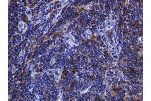 Immunohistochemistry (IHC) image for anti-Sterol O-Acyltransferase 2 (SOAT2) (AA 1-120) antibody (ABIN2715640) (SOAT2 antibody  (AA 1-120))