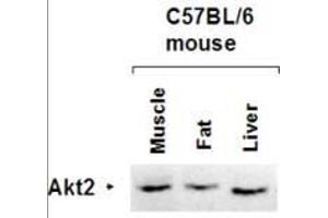 Western Blot of Rabbit anti-AKT2 antibody. (AKT2 antibody  (AA 455-468))