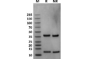 Human FcRn on Coomassie Blue stained SDS-PAGE under non-reducing (NR) and reducing (R) conditions. (FcRn Protein (AA 24-297) (His-Avi Tag))