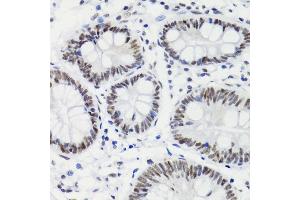 Immunohistochemistry of paraffin-embedded human stomach using Phospho-Bcl-2-T56 antibody (ABIN6134234, ABIN6137497, ABIN6137499 and ABIN6215156) at dilution of 1:200 (40x lens). (Bcl-2 antibody  (AA 1-100))
