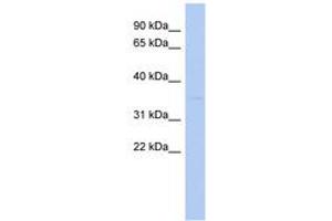 Image no. 1 for anti-STIP1 Homology and U-Box Containing Protein 1 (STUB1) (N-Term) antibody (ABIN6743148) (STUB1 antibody  (N-Term))