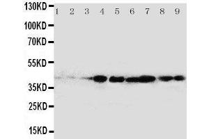 Western Blotting (WB) image for anti-V-Crk Sarcoma Virus CT10 Oncogene Homolog (Avian)-Like (CRKL) (AA 286-303), (C-Term) antibody (ABIN3043046) (CrkL antibody  (C-Term))