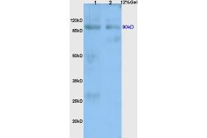 SDS-PAGE (SDS) image for anti-Toll-Like Receptor 4 (TLR4) (AA 751-835) antibody (ABIN736491)