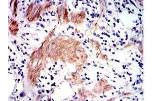 Immunohistochemistry (IHC) image for anti-Glutathione S-Transferase mu 1 (GSTM1) antibody (ABIN969181)