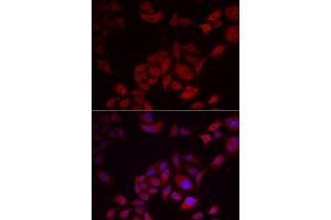 Immunofluorescence analysis of U2OS cells using PIKFYVE antibody (ABIN5974035). (PIKFYVE antibody)