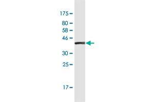 Western Blot detection against Immunogen (36. (MAP4 antibody  (AA 1-99))