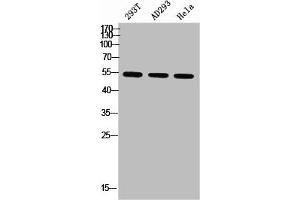 Western blot analysis of 293T AD293 Hela using p-Parkin (S131) antibody. (Parkin antibody  (pSer131))