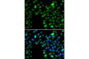 Immunofluorescence analysis of MCF-7 cells using ING5 antibody (ABIN5974390). (ING5 antibody)