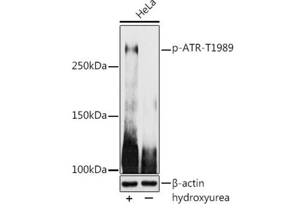 ATR antibody  (pThr1989)