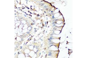 Immunohistochemistry of paraffin-embedded human colon using SERPINA7 antibody at dilution of 1:100 (40x lens). (SERPINA7 antibody)