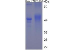 Image no. 1 for Fatty Acid Desaturase 1 (FADS1) (AA 25-37) peptide (Ovalbumin) (ABIN5666167) (Fatty Acid Desaturase 1 (FADS1) (AA 25-37) peptide (Ovalbumin))