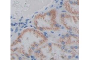 IHC-P analysis of Human Tissue, with DAB staining. (STAR antibody  (AA 1-285))