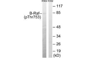 Western blot analysis of extracts from K562 cells treated with EGF using B-Raf (Phospho-Thr753) Antibody. (BRAF antibody  (pThr753))