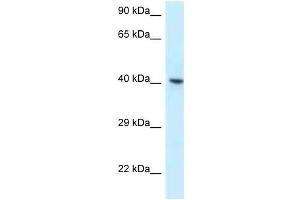 Western Blot showing RBMX antibody used at a concentration of 1 ug/ml against OVCAR-3 Cell Lysate (RBMX antibody  (C-Term))