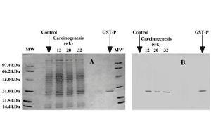 Image no. 1 for anti-Glutathione S-Transferase pi 1 (GSTP1) antibody (ABIN187491) (GSTP1 antibody)