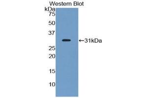 Western blot analysis of the recombinant protein. (EPHA1 antibody  (AA 599-842))