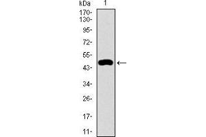 Western Blotting (WB) image for anti-Keratin 5 (KRT5) (AA 316-590) antibody (ABIN1724789)