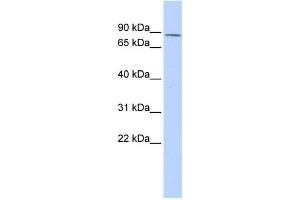 Western Blotting (WB) image for anti-Zinc Finger Protein 667 (ZNF667) antibody (ABIN2458200) (ZNF667 antibody)