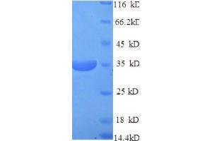 SDS-PAGE (SDS) image for CD46 (CD46) (AA 45-329), (Extracellular) protein (His tag) (ABIN5709237) (CD46 Protein (CD46) (AA 45-329, Extracellular) (His tag))