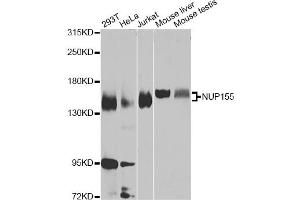 Western blot analysis of extracts of various cell lines, using NUP155 Antibody (ABIN2737273) at 1:1000 dilution. (NUP155 antibody)