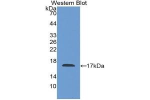 Detection of Recombinant F8, Mouse using Polyclonal Antibody to Coagulation Factor VIII (F8) (Factor VIII antibody  (AA 1854-1988))