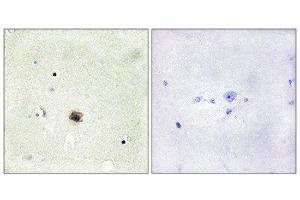 Immunohistochemistry (IHC) image for anti-Cysteine and Glycine-Rich Protein 1 (CSRP1) (Internal Region) antibody (ABIN1849240) (CSRP1 antibody  (Internal Region))