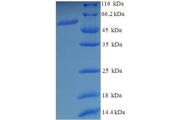 MON1A Protein (AA 205-555, partial) (His-SUMO Tag)