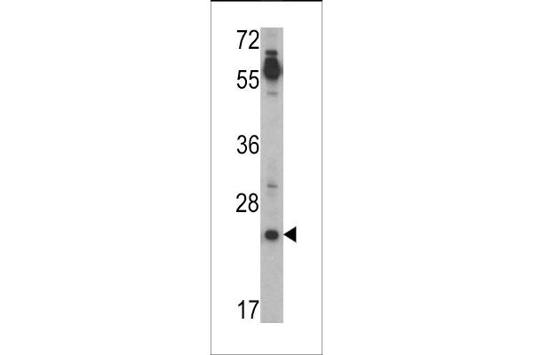 TDGF1 antibody  (N-Term)