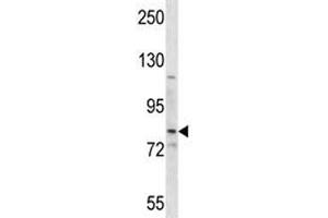 SMO antibody western blot analysis in HepG2 lysate. (SMO antibody  (AA 539-567))