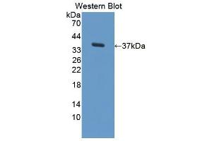 Figure. (Transferrin Receptor 2 antibody  (AA 493-785))