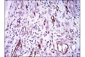 Immunohistochemistry (IHC) image for anti-Goosecoid Homeobox (GSC) (AA 191-257) antibody (ABIN1845980) (GSC antibody  (AA 191-257))