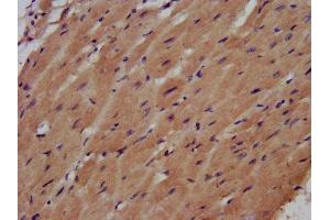 IHC image of ABIN7161246 diluted at 1:500 and staining in paraffin-embedded human heart tissue performed on a Leica BondTM system. (AHNAK antibody  (AA 5689-5801))
