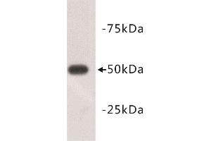 Western Blotting (WB) image for anti-Tubulin, beta 3 (TUBB3) (N-Term) antibody (ABIN1854950) (TUBB3 antibody  (N-Term))