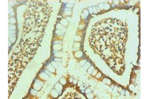 Immunohistochemical of paraffin-embedded human small intestine using ABIN7151798 at dilution of 1:200 (ENO2/NSE antibody)