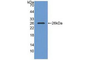 Figure. (RASA1 antibody  (AA 403-596))