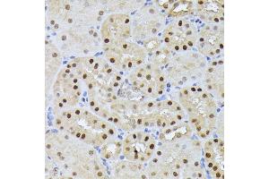 Immunohistochemistry of paraffin-embedded mouse kidney using RPS27A antibody (ABIN7270022) at dilution of 1:100 (40x lens). (RPS27A antibody  (AA 1-156))