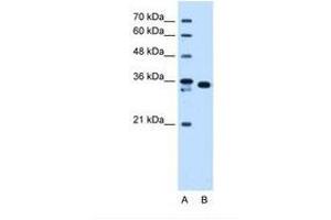 Image no. 1 for anti-Aldo-Keto Reductase Family 1, Member B1 (Aldose Reductase) (AKR1B1) (AA 201-250) antibody (ABIN321393) (AKR1B1 antibody  (AA 201-250))