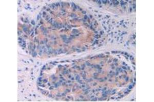 IHC-P analysis of Human Prostate Gland Tissue, with DAB staining. (IL-10RA antibody  (AA 132-235))