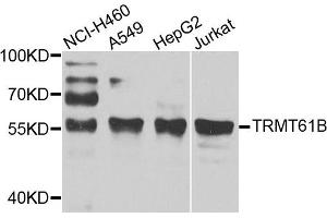 Western blot analysis of extracts of various cell lines, using TRMT61B antibody. (TRMT61B antibody)