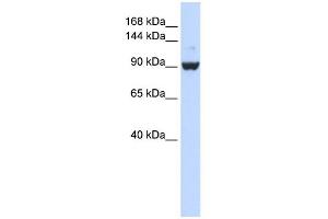 WB Suggested Anti-DHX34 Antibody Titration:  0. (DHX34 antibody  (Middle Region))