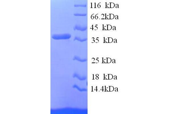 RCN1 Protein (AA 31-331, partial) (His tag)